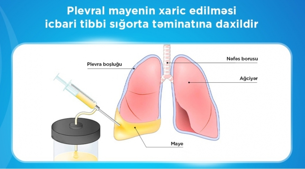agciyerlere-yigilmish-mayenin-chekilmesi-meqsedile-oten-il-5643-prosedur-icra-olunub