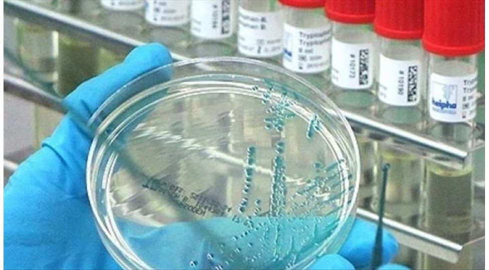 alimler-tehlukeli-virus-tapiblar
