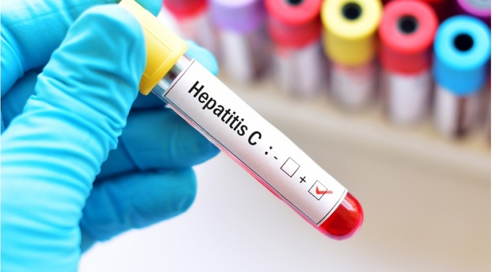 azerbaycanda-qeydiyyata-alinan-hepatit-xestelerinin-sayi-achiqlanib