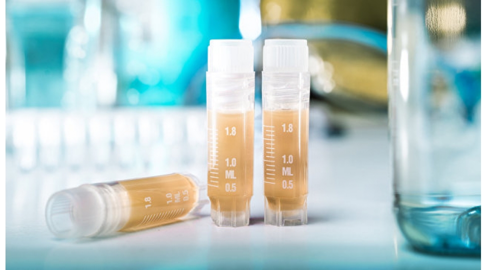 olumcul-virus-yayilib