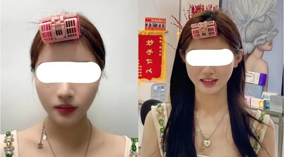 bu-olkede-estetik-emeliyyatlar-suretle-artir-problemden-chixish-yolu-varmi