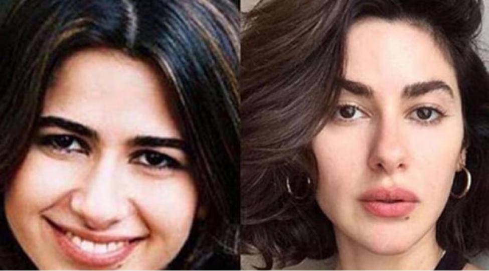 nesrinden-estetik-emeliyyat-ittihamlarina-iyneli-cavab-foto