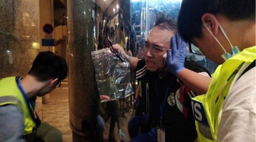 etiraz-aksiyasinda-siyasetchinin-qulagini-qopardilar-video