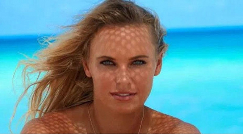 29-yashli-tennischi-sinesiachiq-pozalari-ile-gundemi-zebt-etdi-foto