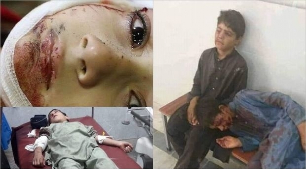 pakistanda-terror-chox-sayda-olenler-ve-yaralananlar-var-fotovideo