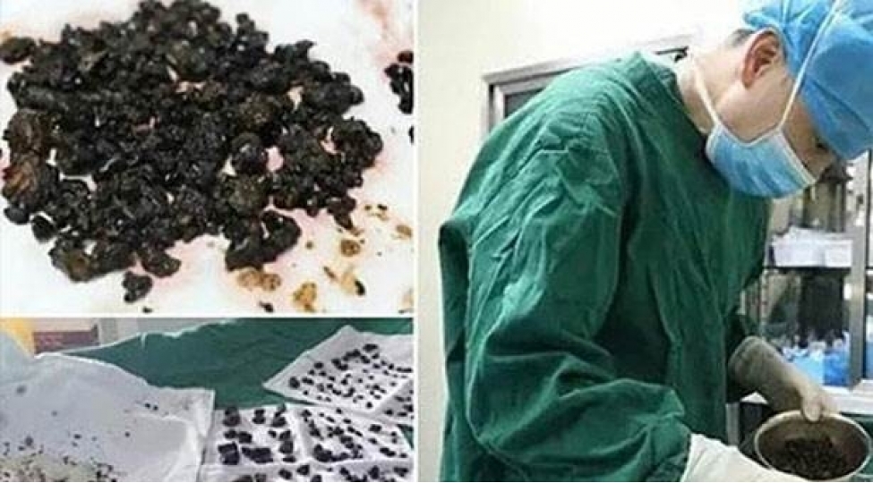 chinde-bir-qadin-her-kesi-shoka-salib