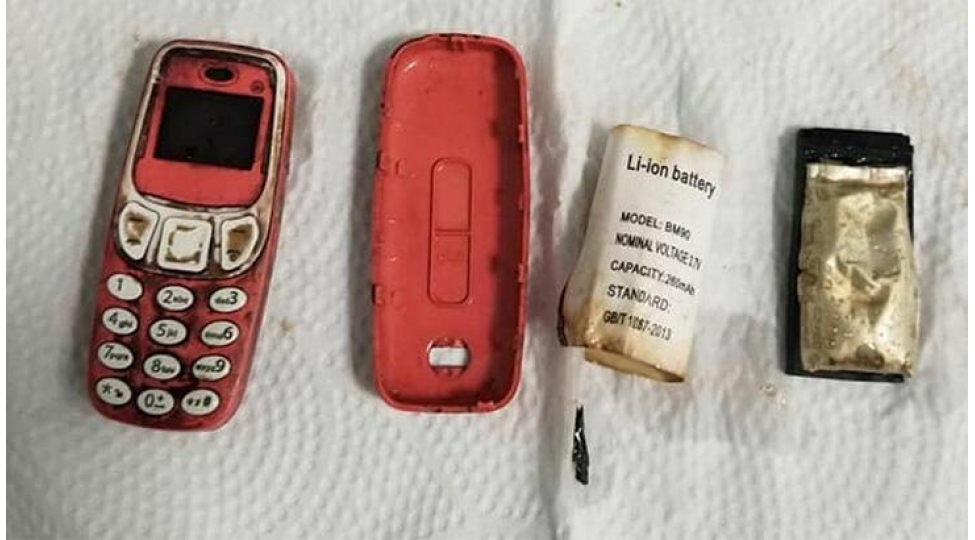 insan-medesinden-ilk-defe-telefon-chixarildi