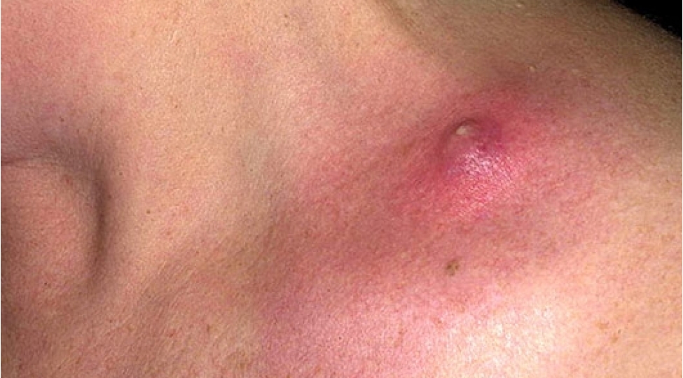 chiban-sebebler-ve-ev-sheraitinde-mualicesi