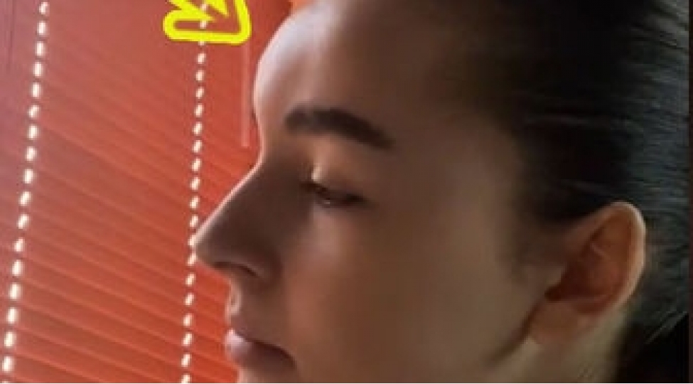 alnindaki-sizanagi-sixan-qizin-bashinda-shish-yarandi