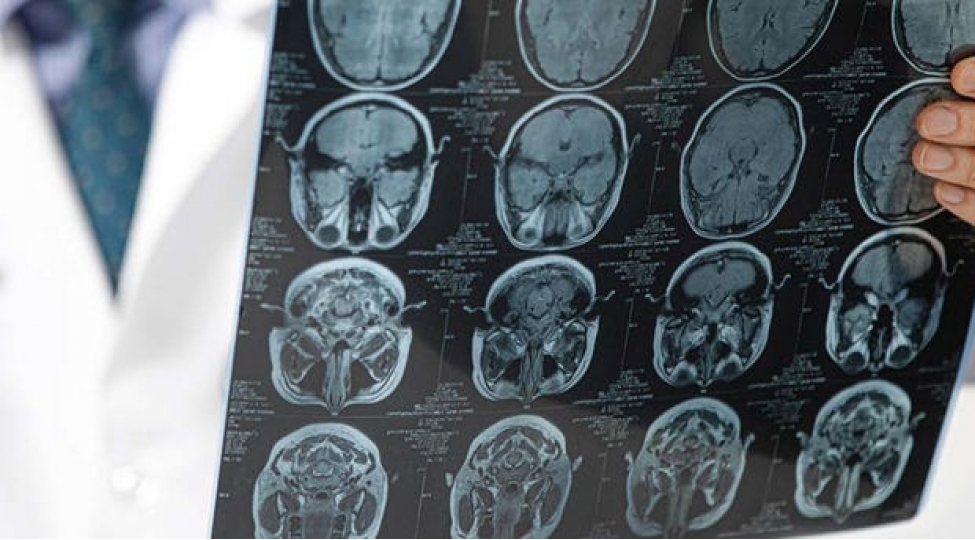 turkiyeli-infeksionist-hekimden-bed-xeber