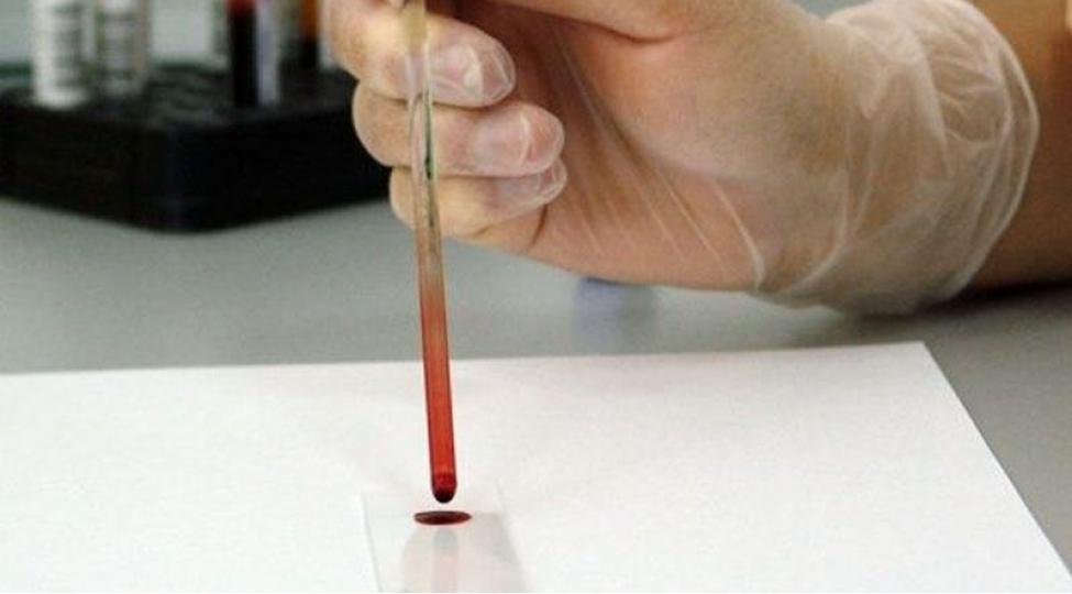 xerchengi-10-il-evvelceden-ashkar-eden-test