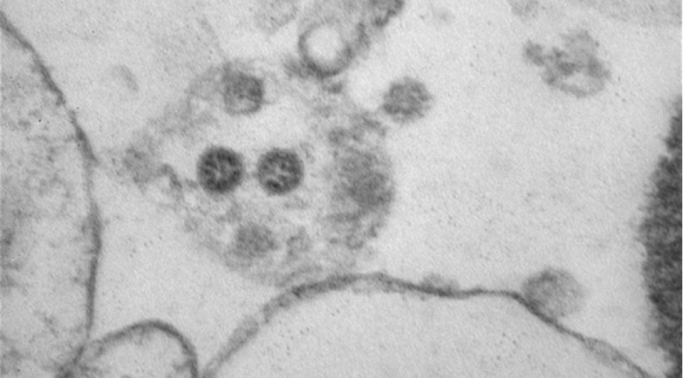 omikron-shtamminin-fotolari-derc-olunub-foto