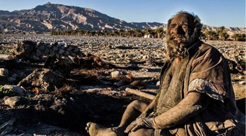 67-ildir-chimmeyen-kishini-muayine-eden-hekimlershoka-dushdu