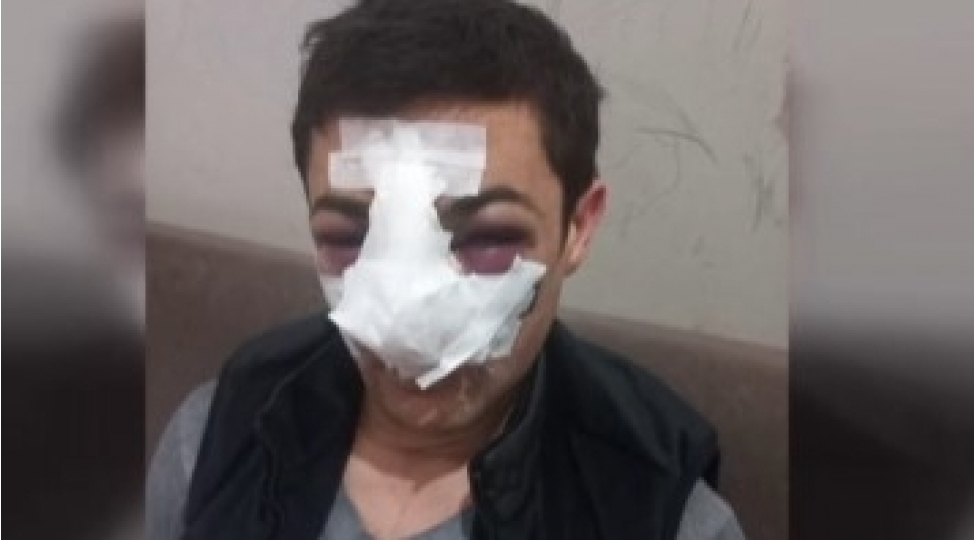 avtobus-surucusu-niye-doyulub-video