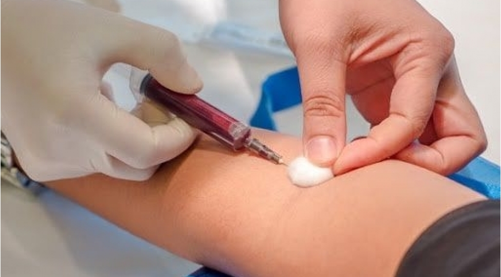 covid-den-sagalan-her-kes-qan-qatiligini-yoxlatsin-virusoloqdan-xeberdarliq