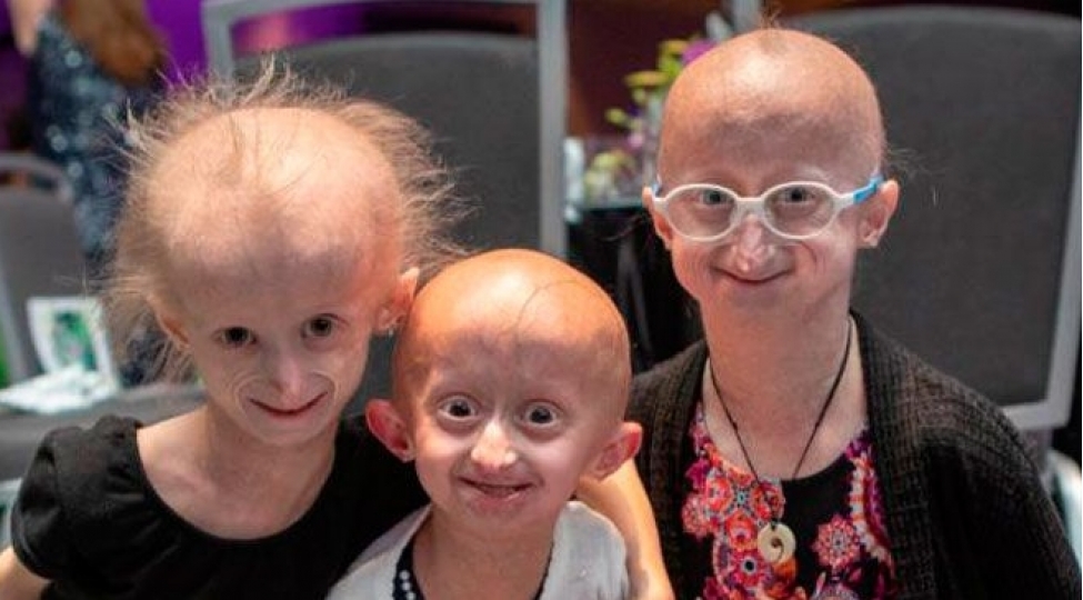 28-fevral-beynelxalq-nadir-xestelikler-gunudur