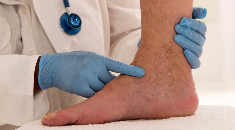 covid-den-sagalanlarda-tromblashma-riski-kardioloqdan-achiqlama