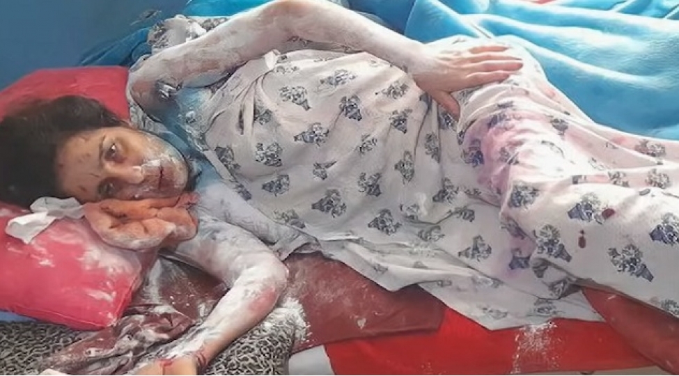 qayinatasi-gelinin-uzune-kislota-tokub-deyirmish-ki-oglumun-pullarini-mene-ver