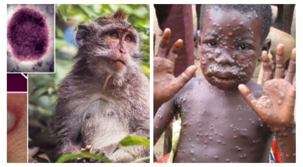 italiya-ve-isvechde-meymun-chicheyi-xesteliyi