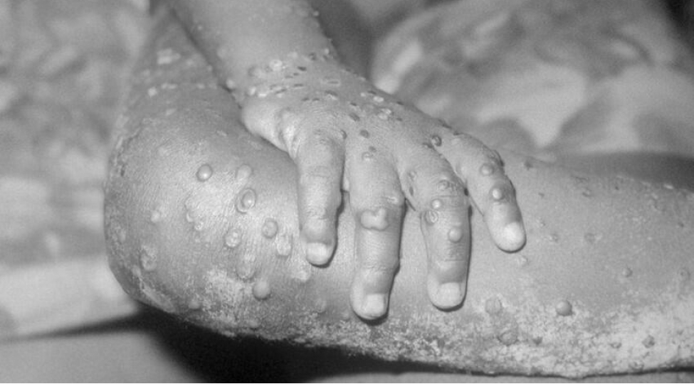 meymun-chicheyine-gore-karantin-neche-gun-olacaq-2