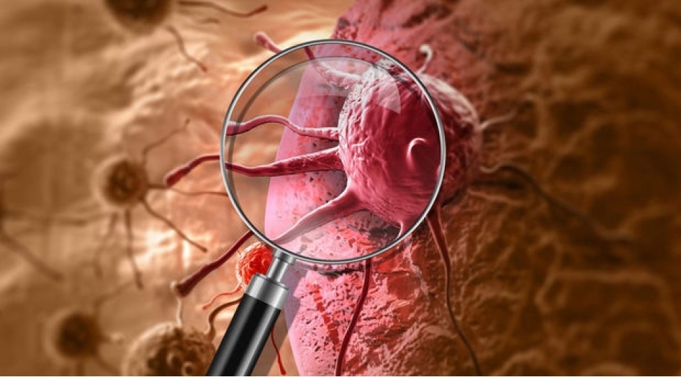 xerchengin-mualicesi-uchun-yeni-hedef-tapildi