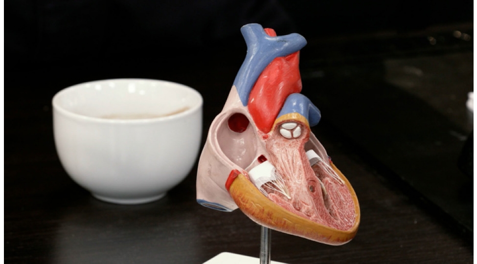 infarktla-bagli-bildiklerimizin-choxu-mif-imish