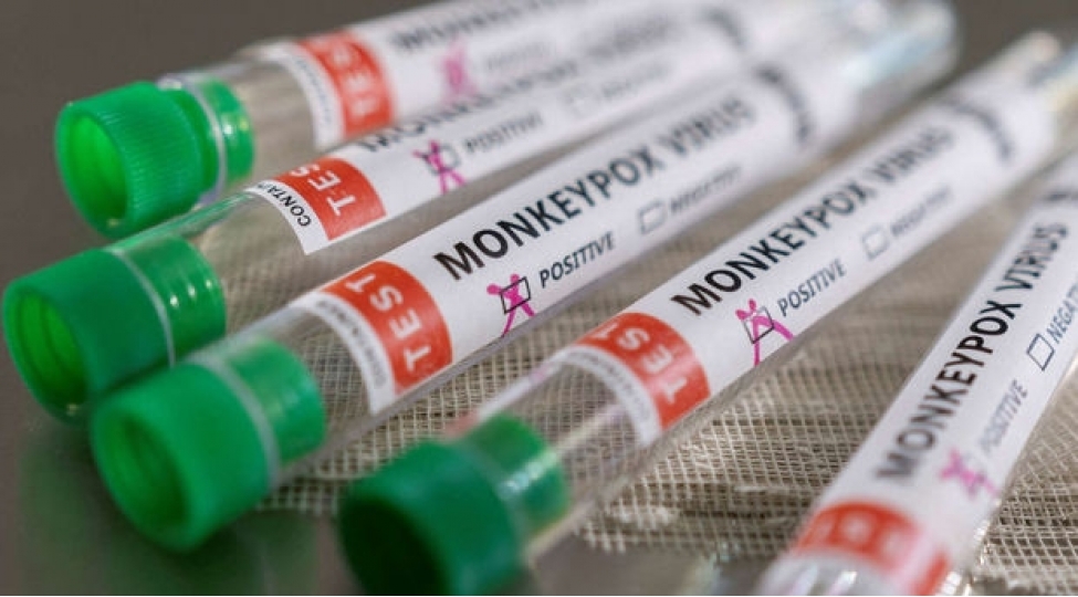 kimler-meymunchicheyini-agir-kechirir