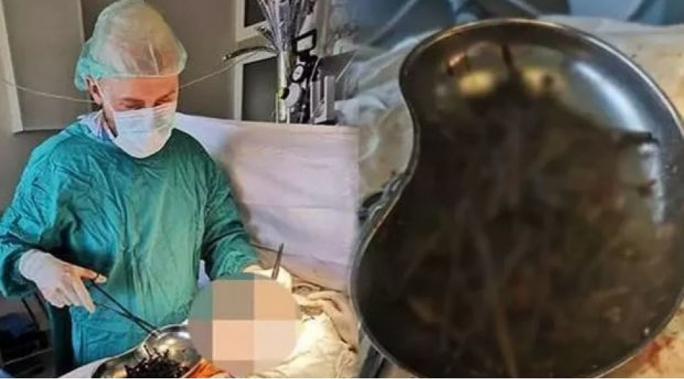 qizin-medesinden-bir-ovuc-mismar-chixdi