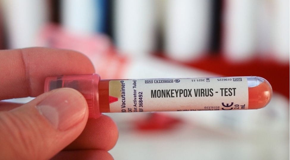 meymunchicheyi-virusu-deyishir-alimler-yeni-mutasiya-dalgasini-ashkarladilar