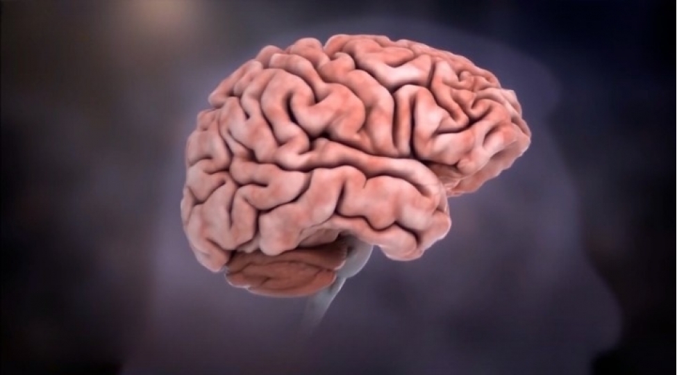 yashla-bagli-demensiyadan-nece-qorunmaq-olar