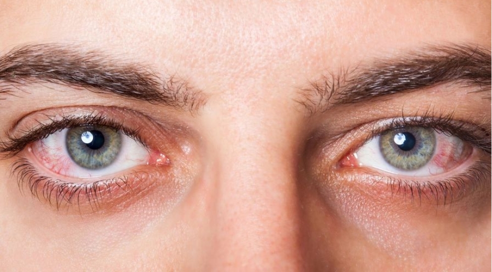 koronavirus-gozlerden-de-kechir