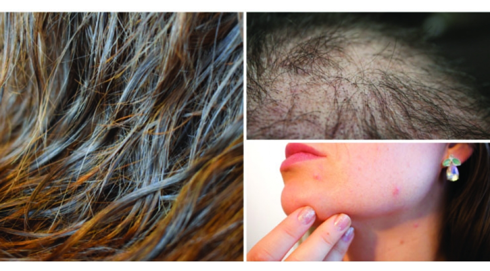 sachlari-yash-halda-yatmagin-fesadlaridan-xeberiniz-varmi