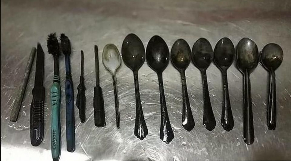 kishinin-medesinden-63-qashiq-chixdi