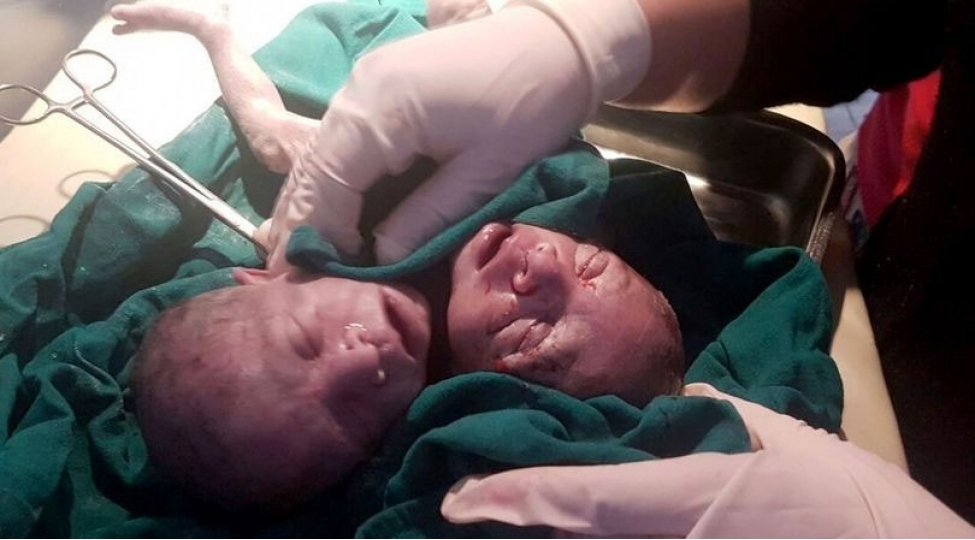 bir-bedende-iki-canfoto