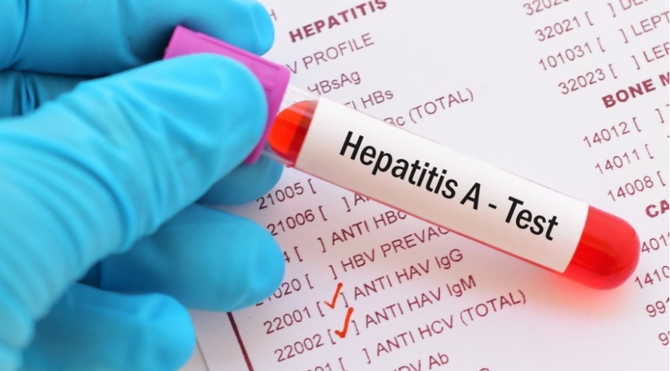 hepatit-a-dan-nece-qorunmali