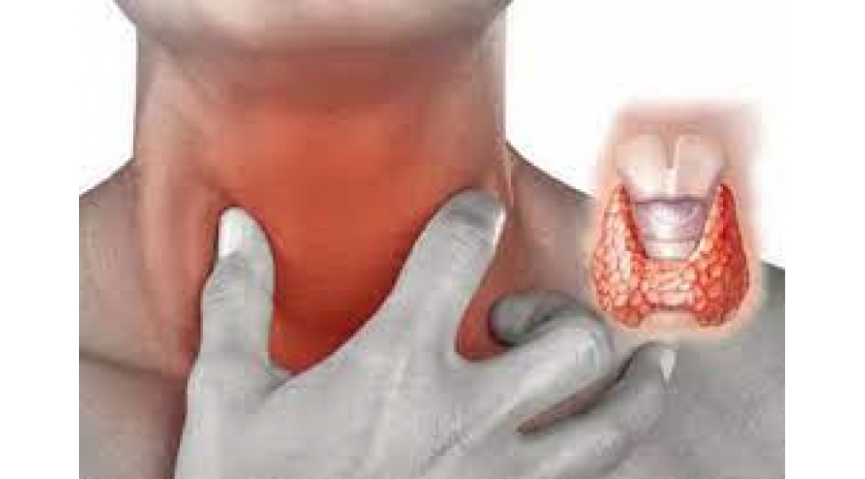 qalxanabenzer-vezin-duyunleri-panikaya-sebeb-varmi