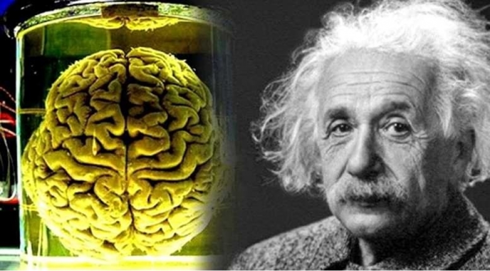 dahilik-ve-meshhurluq-hech-de-xoshbextlik-deyilmish