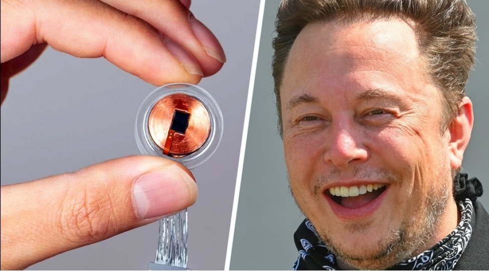 ilon-maskin-shirketine-beyin-chiplerini-insanlar-uzerinde-sinaqdan-kechirmeye-icaze-verilib