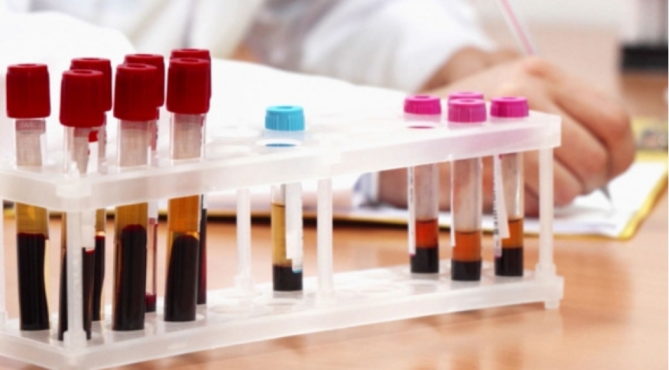 qan-testi-omru-nece-uzadir