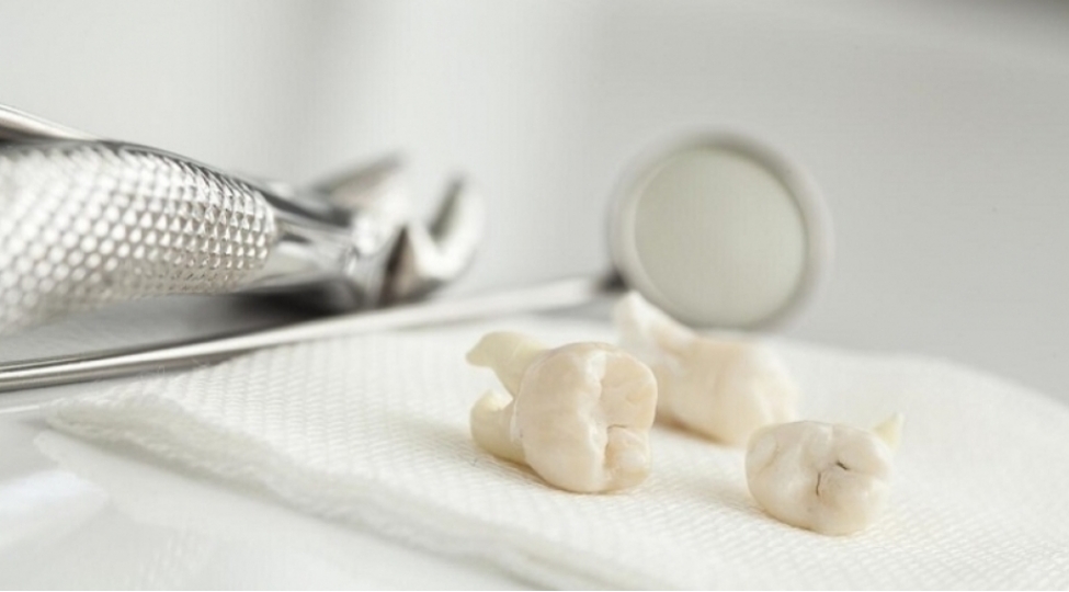 fevralin-9-u-beynelxalq-stomatoloq-gunudur-2