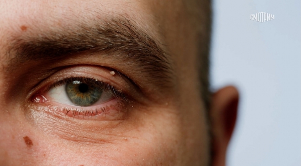 tehlukeli-xallara-qarshi-diqqetli-olun