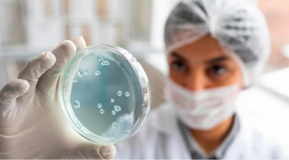 orqanizmi-artiq-xolesteroldan-qoruyan-mikroflora-bakteriyalari-mueyyen-edilmishdir