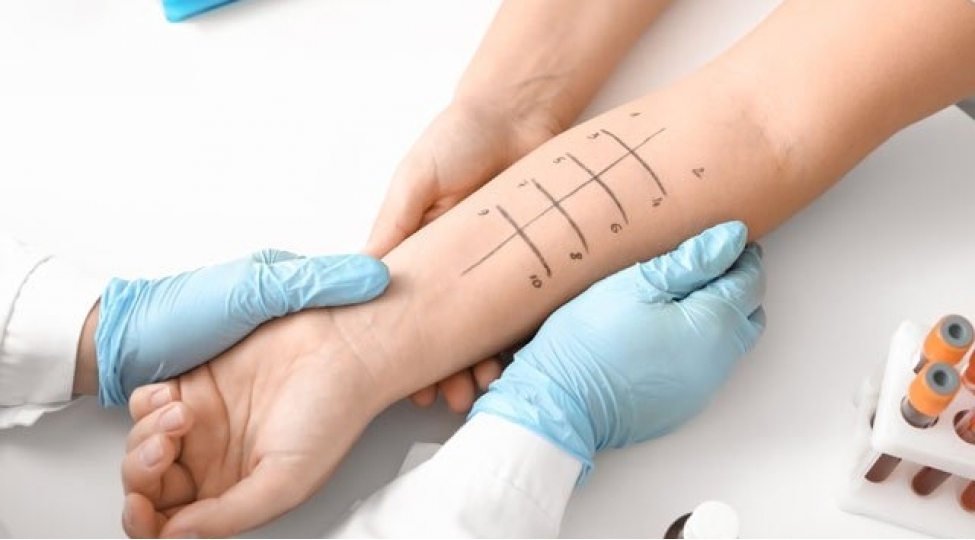 allergiya-xerchengden-qoruyur