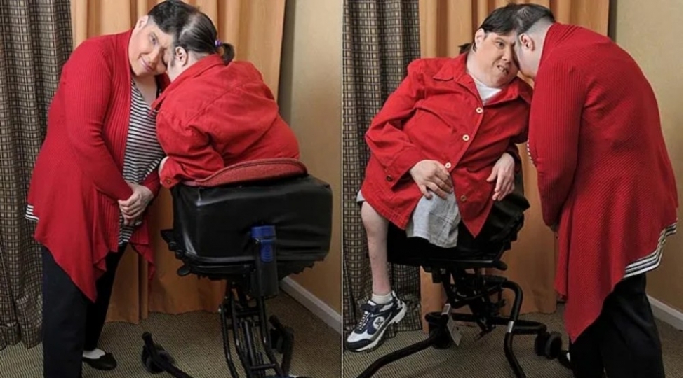 dunyanin-en-yashli-siam-ekizleri-vefat-etdi-2