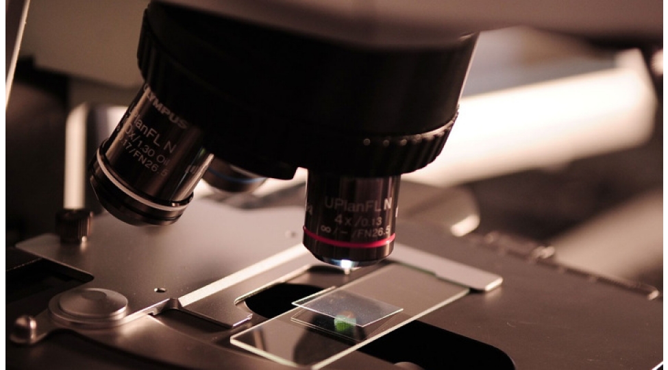 bakteriyalar-qizil-chixaracaq