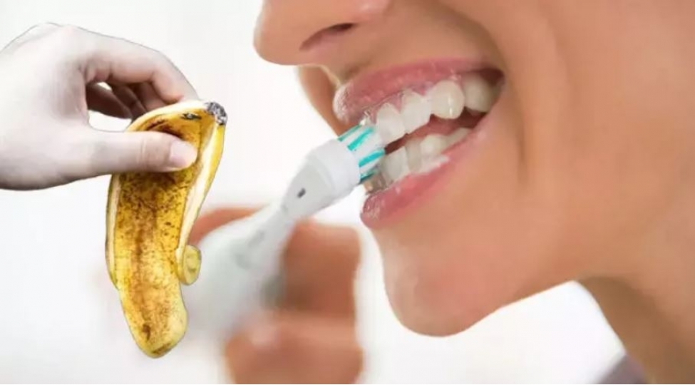 dishleri-agappaq-etmeyin-yeni-usullari