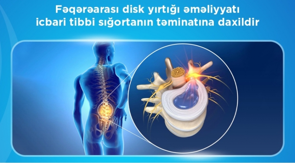 oturaq-heyat-terzi-zede-ve-travmalar-fiziki-yuklenme-artiq-cheki