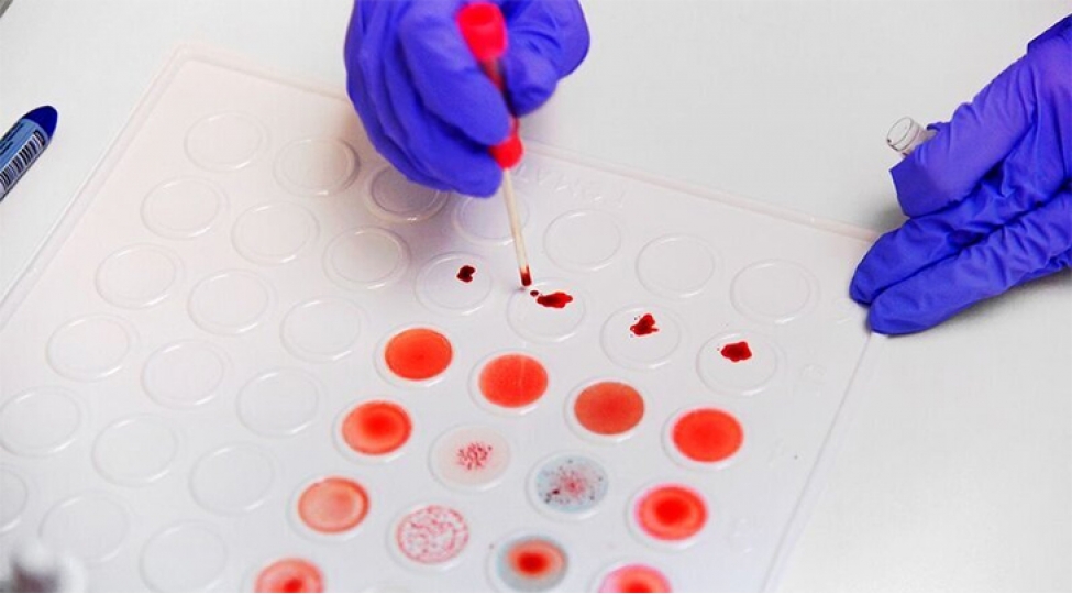 dunyanin-en-nadir-qan-qrupu-ashkarlanib