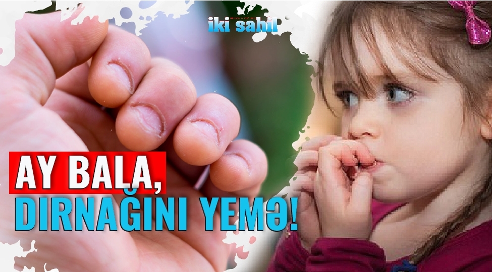 sen-deme-dirnaq-yemek