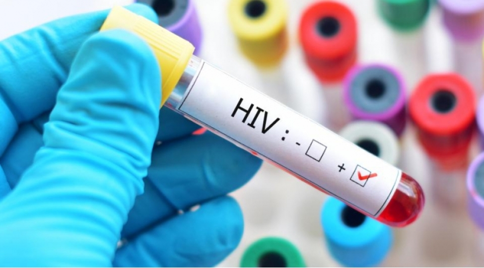 bmt-bu-onilliyin-sonuna-qeder-uch-milyondan-chox-insan-hiv-e-yoluxa-biler